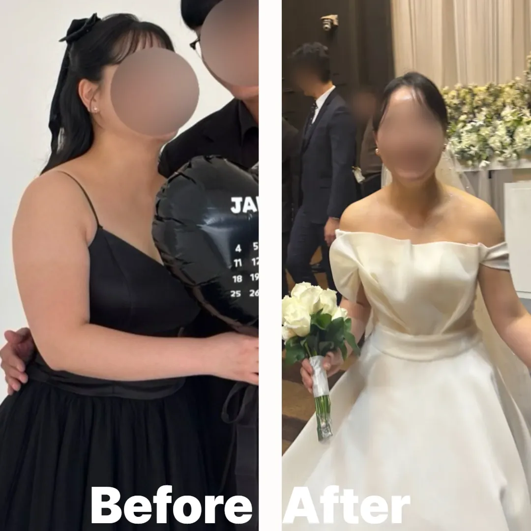 복부비만 케어 결과 웨디아 여수웅천점