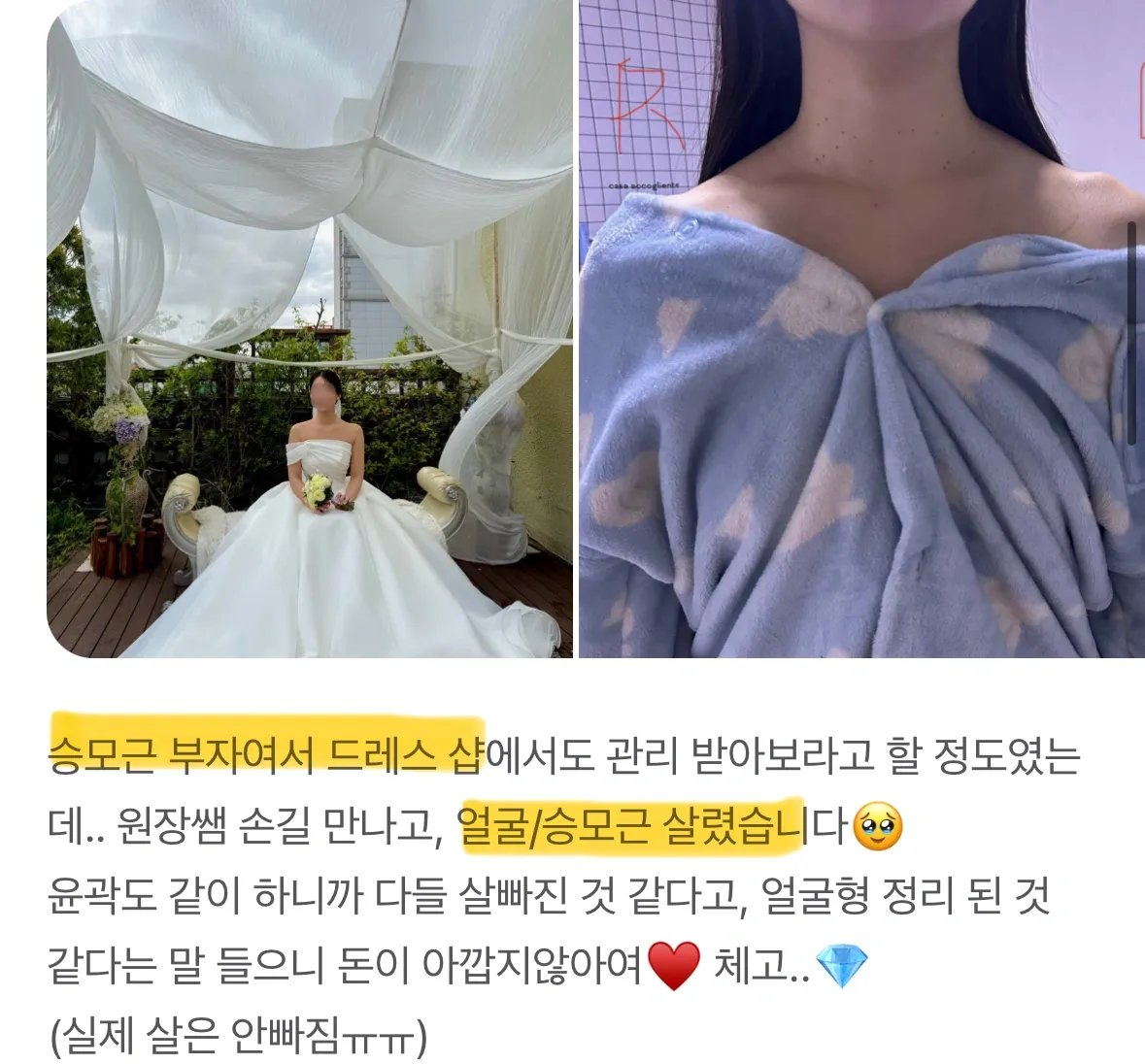 여수체형관리 고객 후기 2 웨디아 여수웅천점